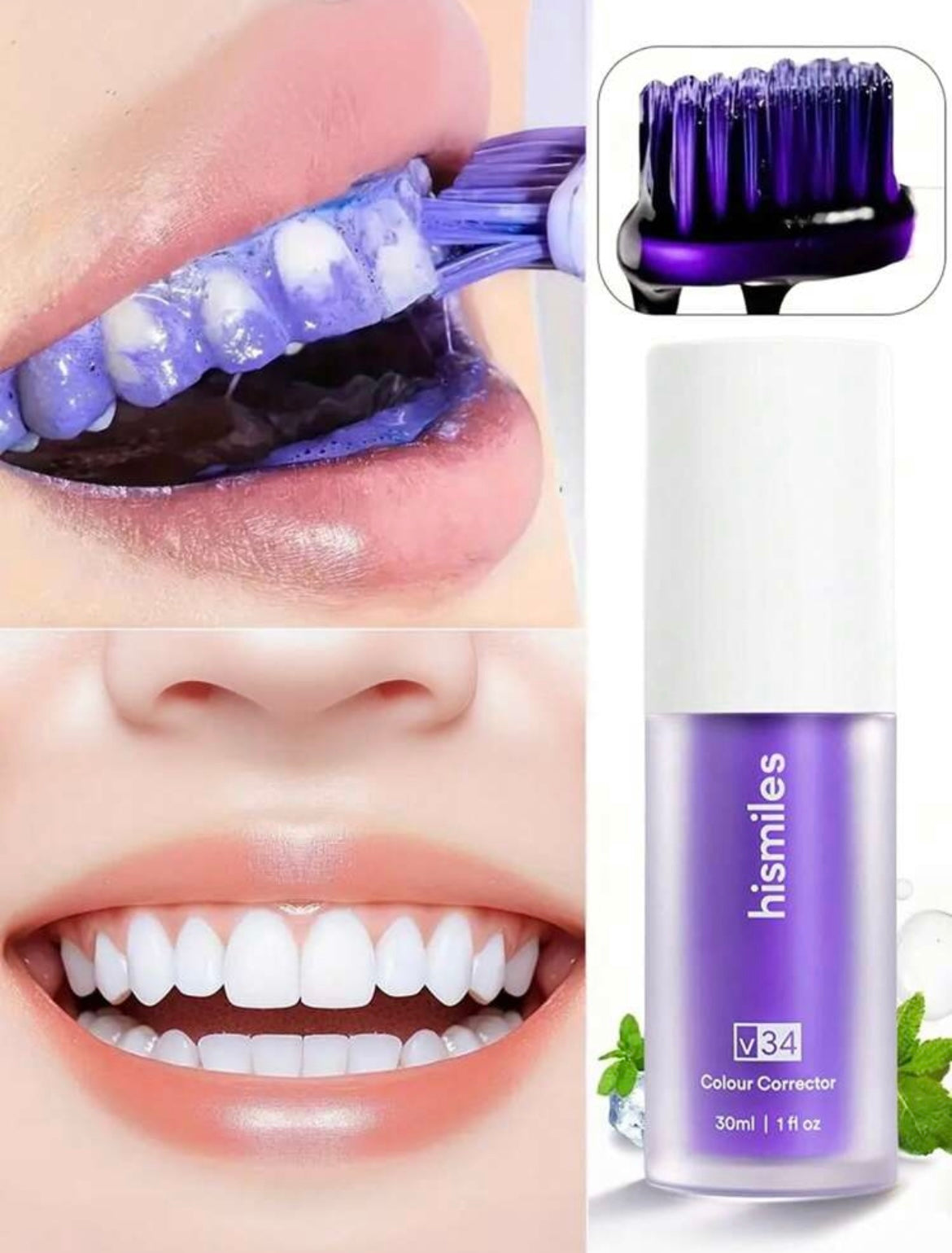 Teeth whitening